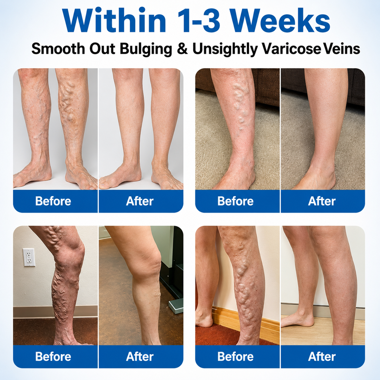🇺🇸🏆✅️🏃VeinRepair Microneedle Patch Roll⚡Instant Relief, Long-Term Results-Q1