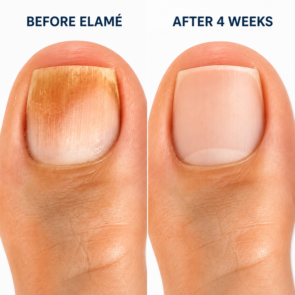 Nail Repair 💅 Patches ✨ –Help protect and reinforce damaged nails with easy-to-use repair patches-QR