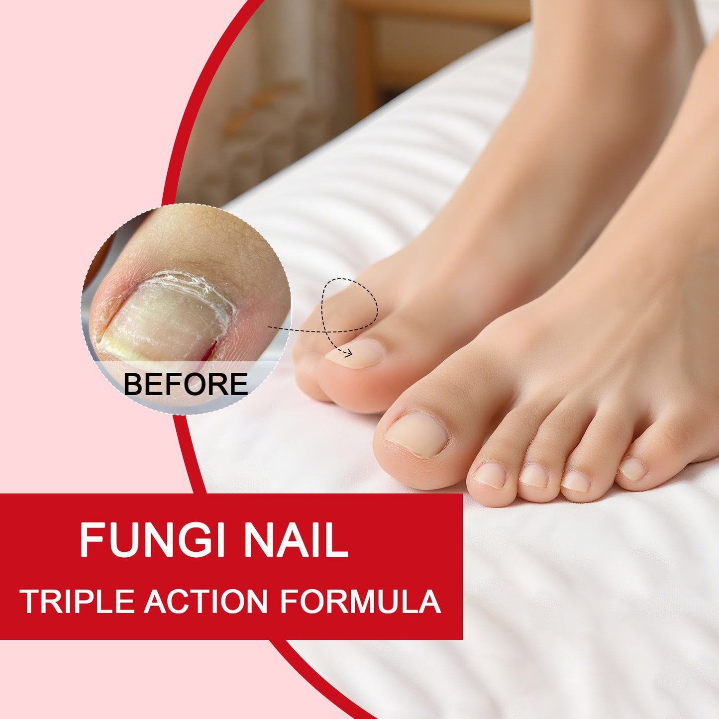 🦶✨ Restore the Look of Healthy Nails – Fast, Easy Daily Care with Special Effect Toenail Care Solution 💧-QO