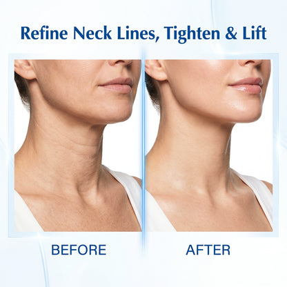 Your Neck Isn't Aging. It's Being Crushed-QO