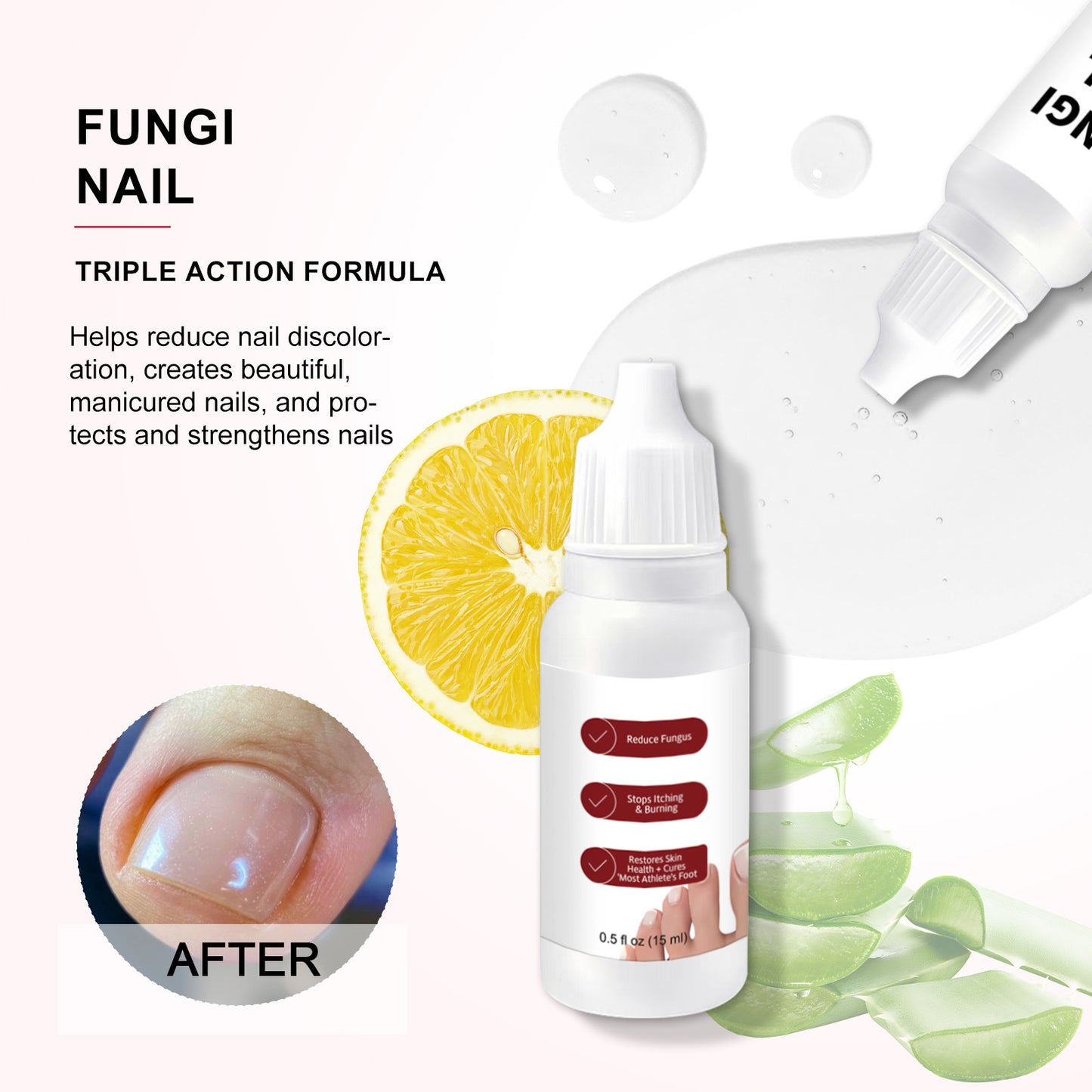 🦶✨ Restore the Look of Healthy Nails – Fast, Easy Daily Care with Special Effect Toenail Care Solution 💧-QO