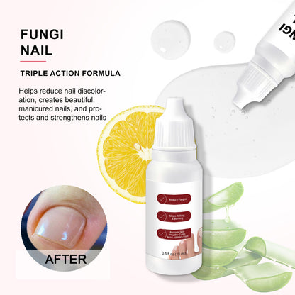 🦶✨ Restore the Look of Healthy Nails – Fast, Easy Daily Care with Special Effect Toenail Care Solution 💧-QO
