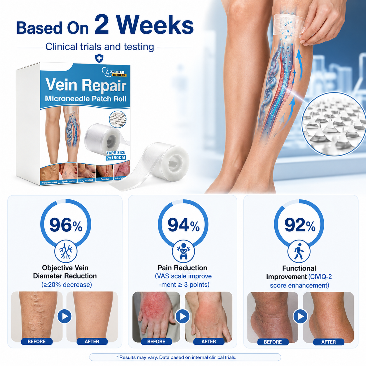 🇺🇸🏆✅️🏃VeinRepair Microneedle Patch Roll⚡Instant Relief, Long-Term Results-Q1