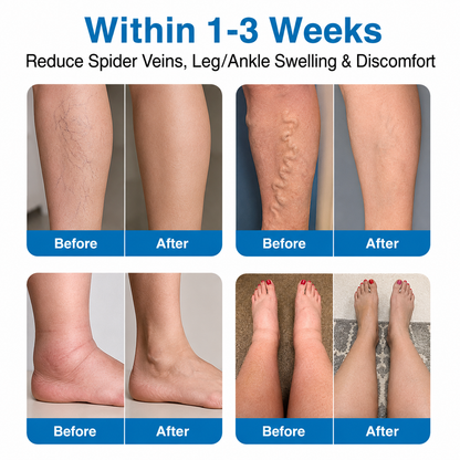 🇺🇸🏆✅️🏃VeinRepair Microneedle Patch Roll⚡Instant Relief, Long-Term Results-Q1