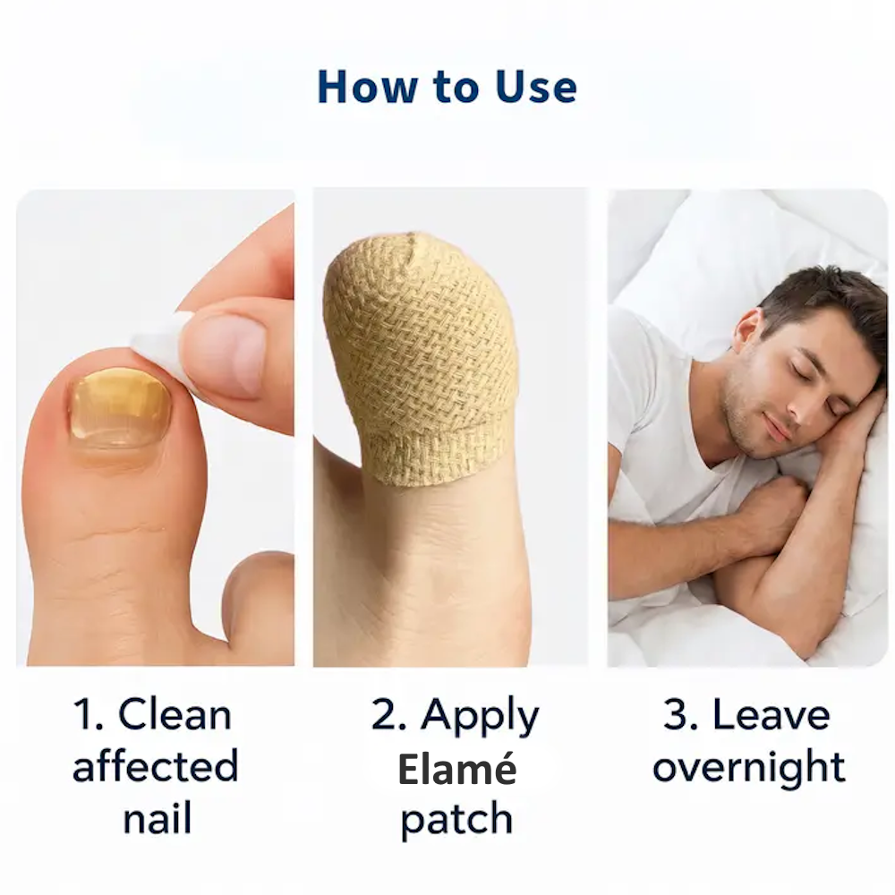 Nail Repair 💅 Patches ✨ –Help protect and reinforce damaged nails with easy-to-use repair patches-QR