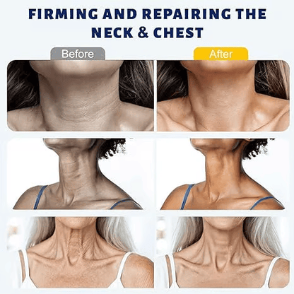 Instant Neck Lift ✨ Cream 🧴 – Retinol 🌿 & Hyaluronic Acid 💧 Formula for Smoother-Looking Neck Skin-QR