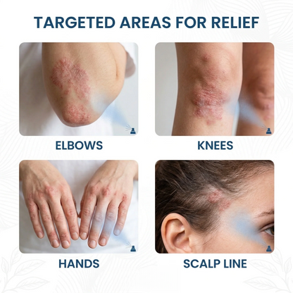 🔥 Magnesium 🌿 Botanical Spray ✨ – Soothing Skin Care 💧 for Dry & Sensitive Skin-QR
