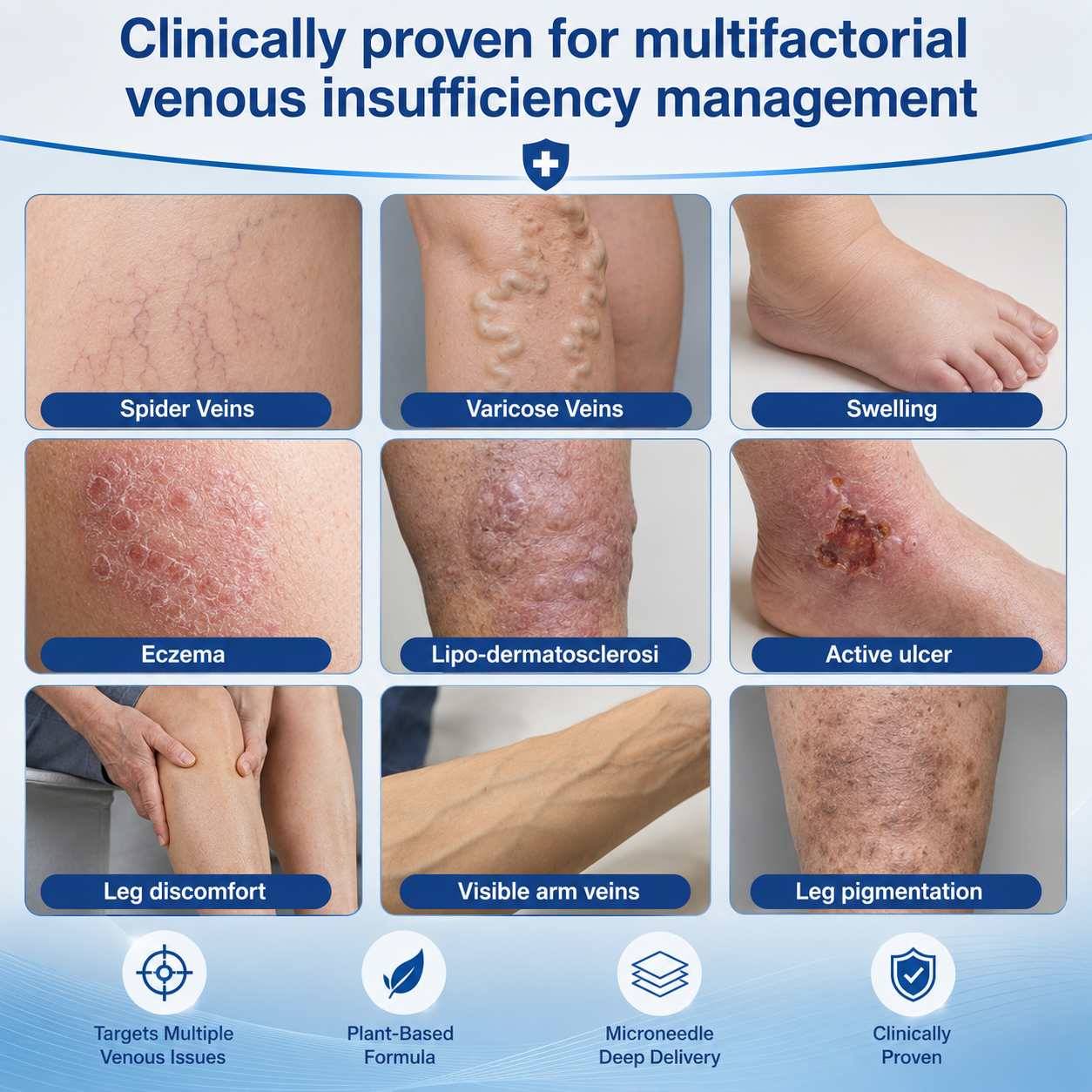 🇺🇸🏆✅️🏃VeinRepair Microneedle Patch Roll⚡Instant Relief, Long-Term Results-Q1