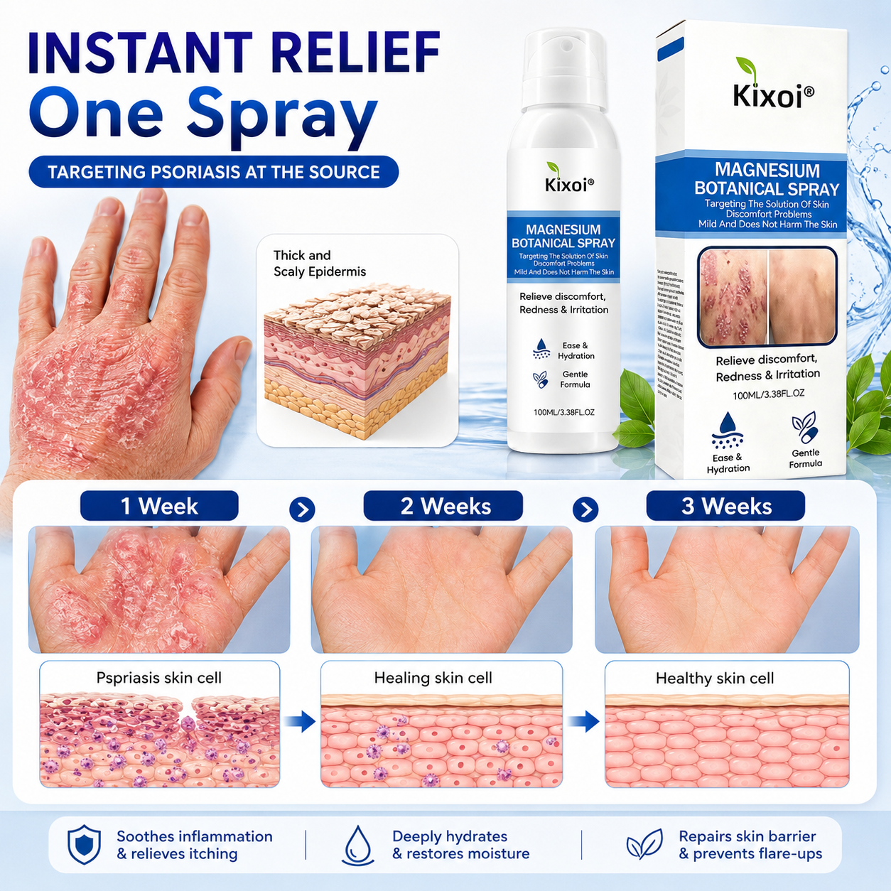 🔥Magnesium Botanical Spray – Advanced Skin Recovery for Psoriasis & Eczema-Q1