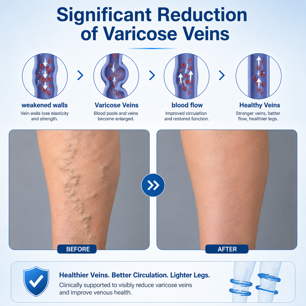 🇺🇸🏆✅️🏃VeinRepair Microneedle Patch Roll⚡Instant Relief, Long-Term Results-Q1