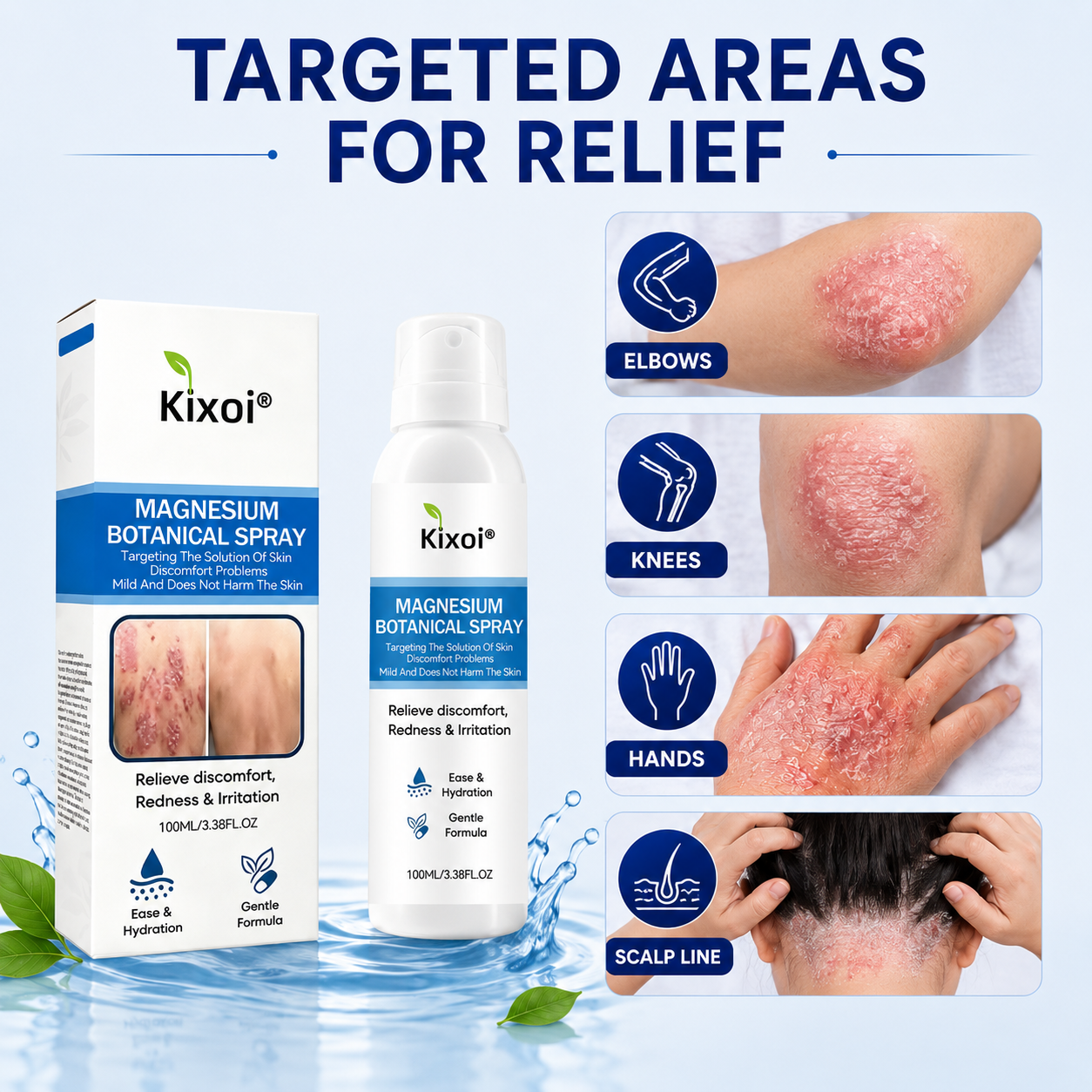 🔥Magnesium Botanical Spray – Advanced Skin Recovery for Psoriasis & Eczema-Q1
