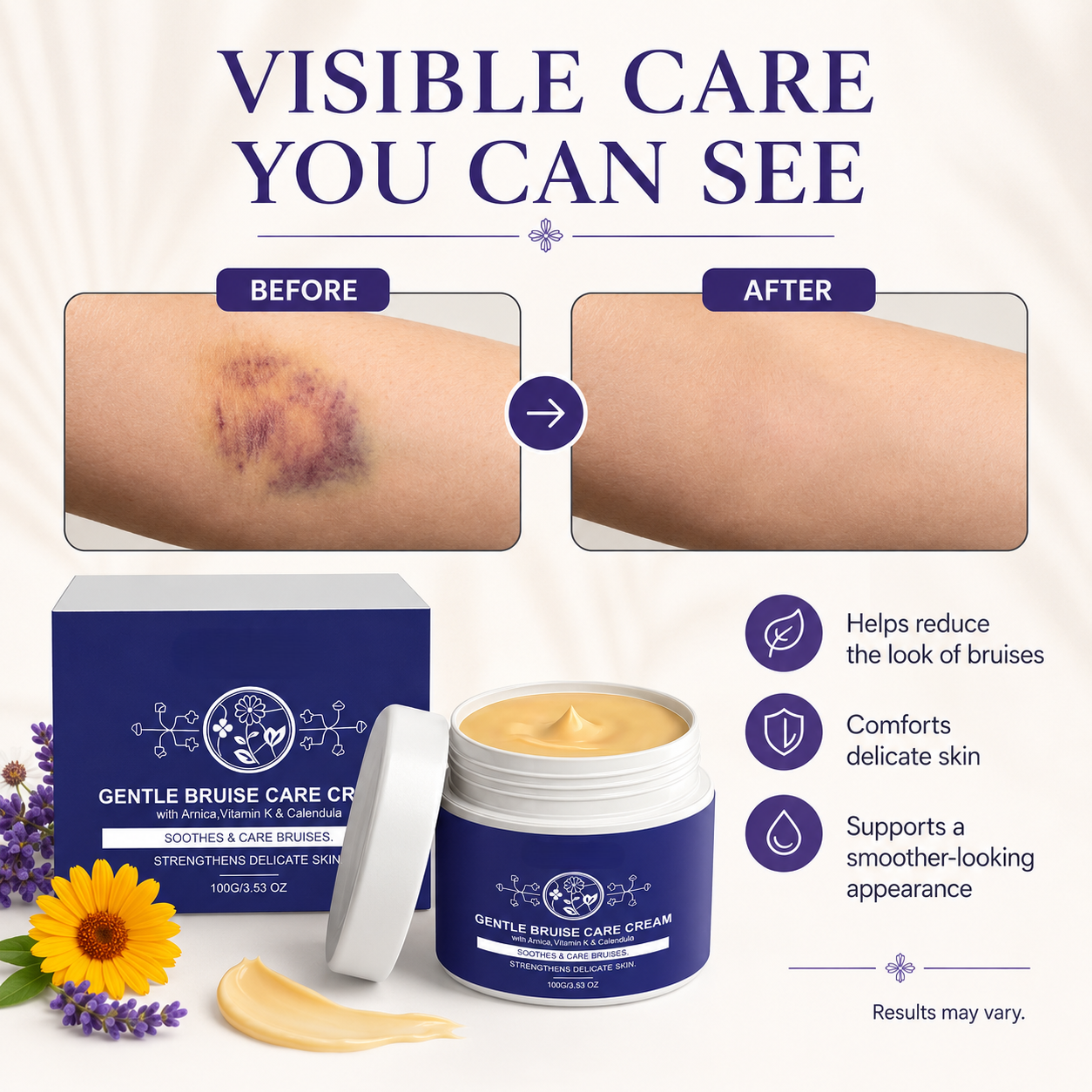 🌼 Advanced Bruise Relief Treatment Cream – Arnica + Vitamin K Skin Recovery Balm -DW