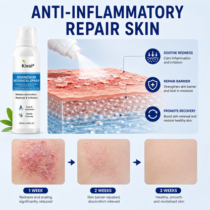 🔥Magnesium Botanical Spray – Advanced Skin Recovery for Psoriasis & Eczema-Q1