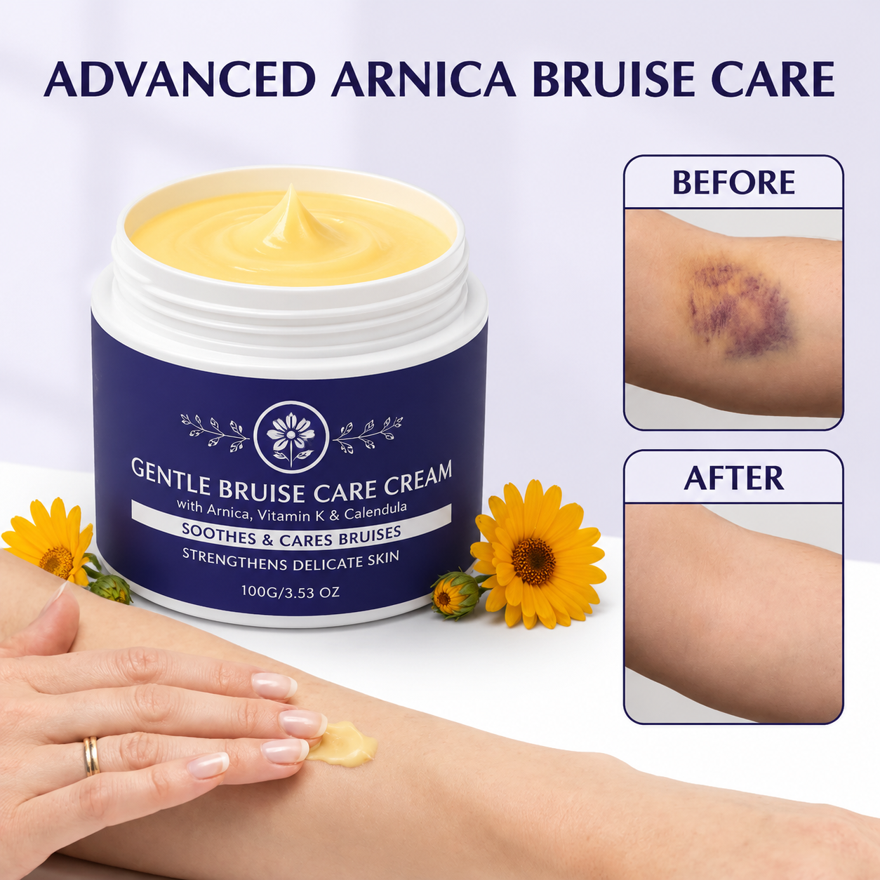 🌼🌼🌼🌼 Skin Recovery Care Balm ✨ – Soothing Support for Bruised & Sensitive Skin-QR