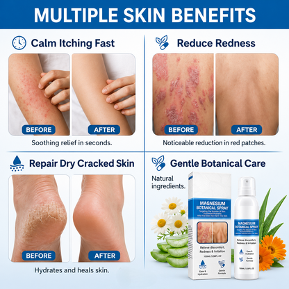🔥 Magnesium 🌿 Botanical Spray ✨ – Soothing Skin Care 💧 for Dry & Sensitive Skin-QR