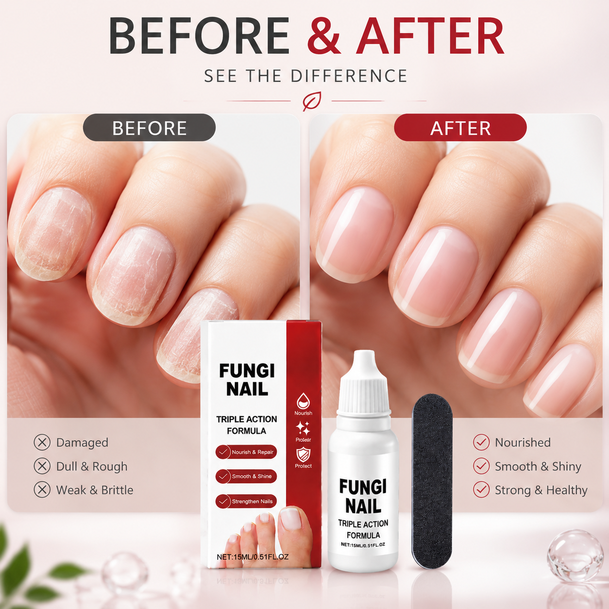 💧 Fungi Triple Action Nutrient Oil – Natural Care Drops for Damaged Nails-QE