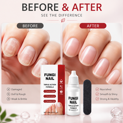 💧 Fungi Triple Action Nutrient Oil – Natural Care Drops for Damaged Nails-QE