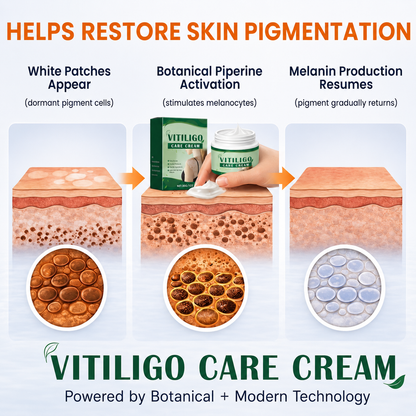 ✨ VITILIGO CARE CREAM | Helps Improve the Look of Uneven Skin Tone-QO
