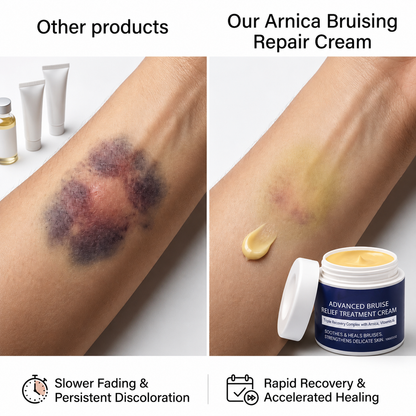 🌼🌼🌼🌼 Completely eliminates bruises, removes body contusions and various scars, deeply repairs damaged skin, reduces swelling and discomfort, and restores healthy skin-QO