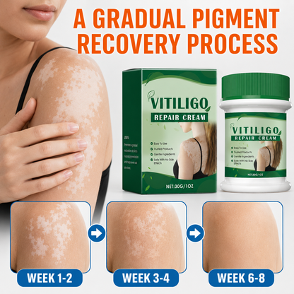✨ VITILIGO CARE CREAM | Helps Improve the Look of Uneven Skin Tone-QO