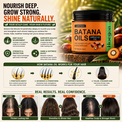 🔥 Batana Oils Miracle Oil – Hair Growth Support for Thicker, Fuller & Healthier-Looking Hair-FX