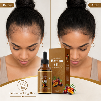 🌿✨ Batana Hair Care Essential Oil – Daily Hair & Scalp Support for Stronger, Healthier-Looking Hair 💖-QO