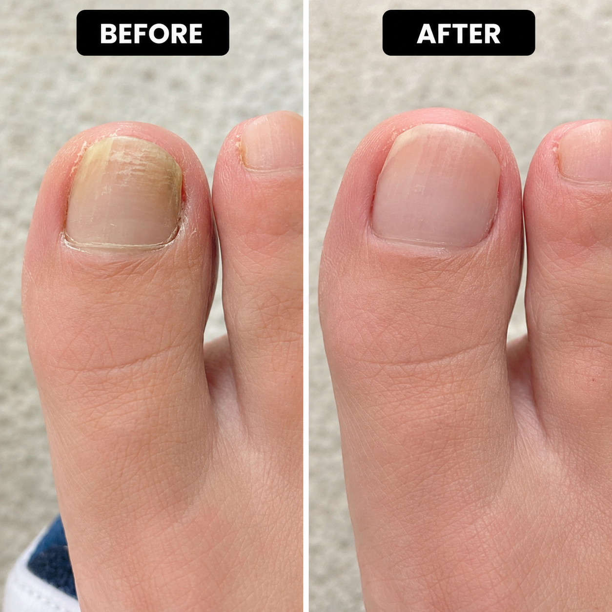 Multi-Purpose 💅 Nail Repair ✨ – Strengthening 🌸 & Smoothing Care for Healthier-Looking Nails 💖-QR