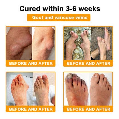 Botulinum Toxin & Bee Venom Pain-Relief Bone Healing Cream -QO