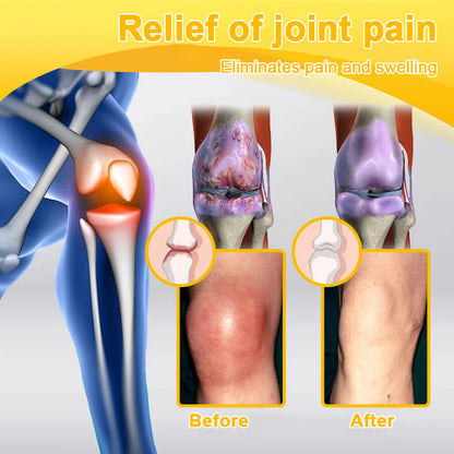 Botulinum Toxin & Bee Venom Pain-Relief Bone Healing Cream -QO