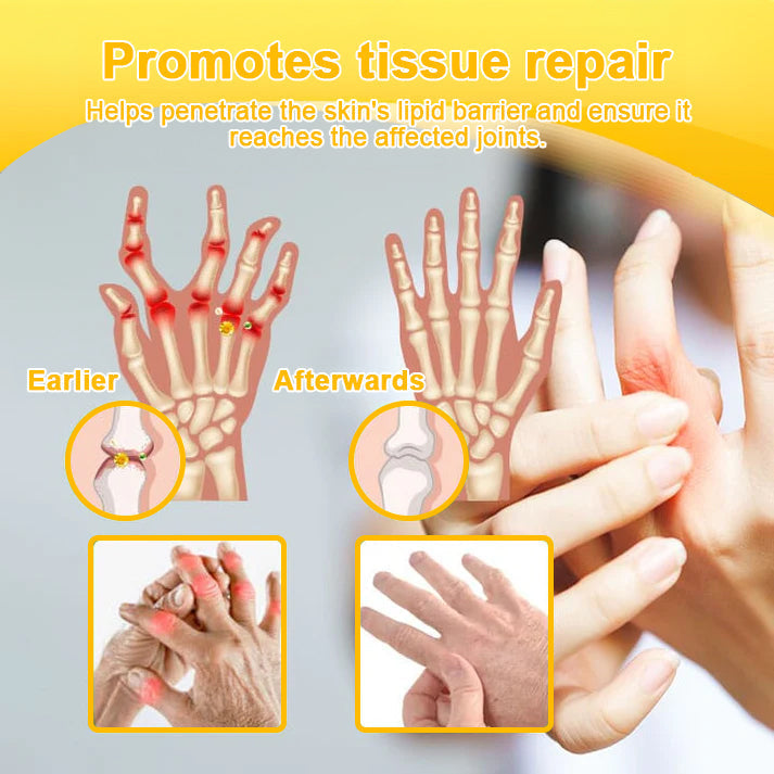 Botulinum Toxin & Bee Venom Pain-Relief Bone Healing Cream -QO