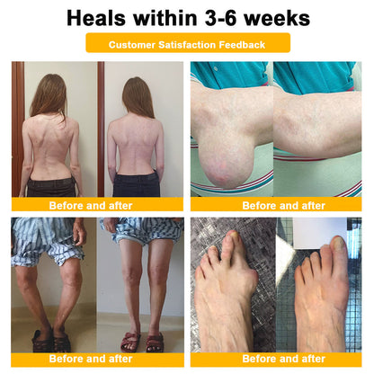 Botulinum Toxin & Bee Venom Pain-Relief Bone Healing Cream -QO