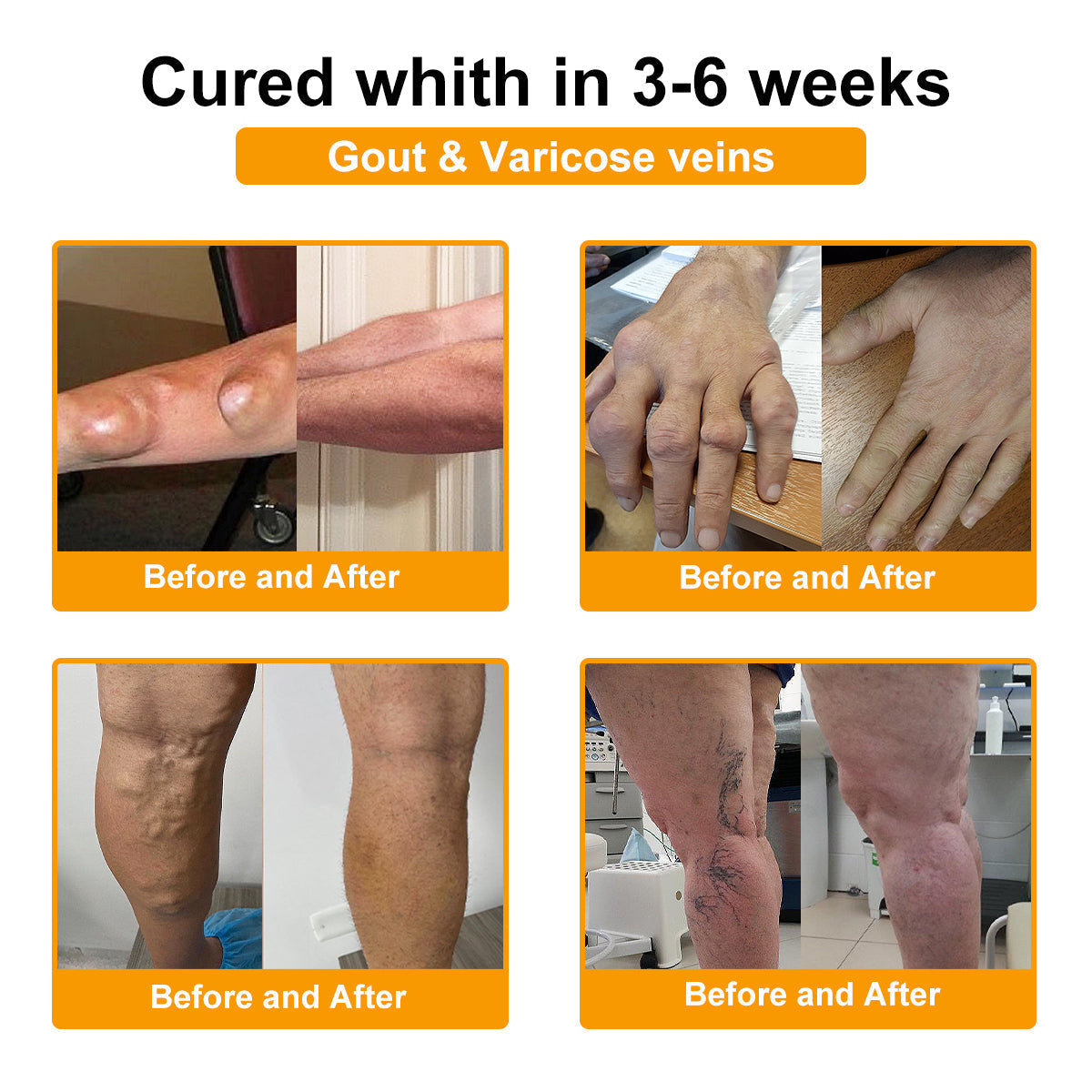 Botulinum Toxin & Bee Venom Pain-Relief Bone Healing Cream -QO