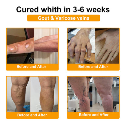 Botulinum Toxin & Bee Venom Pain-Relief Bone Healing Cream -QO