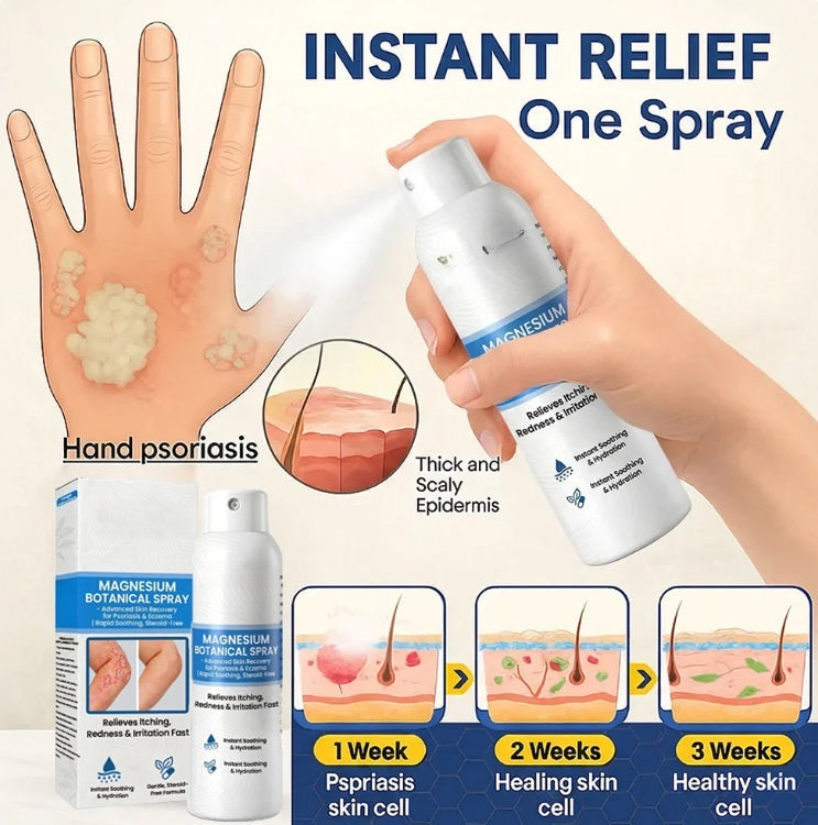 🔥Magnesium Botanical Spray – Advanced Skin Recovery for Psoriasis & Eczema | Rapid Soothing-FX