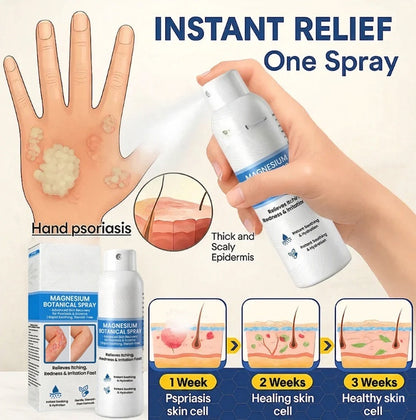 🔥Magnesium Botanical Spray – Advanced Skin Recovery for Psoriasis & Eczema | Rapid Soothing-FX