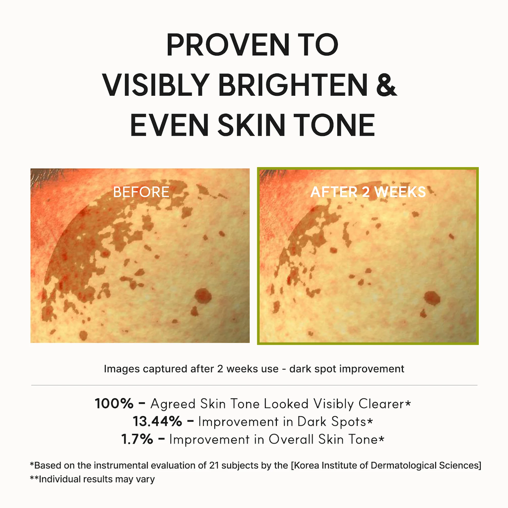 Vitamin C Booster Shot- QO