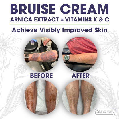 🌼🌼🌼🌼 Skin Recovery Care Balm ✨ – Soothing Support for Bruised & Sensitive Skin-QR