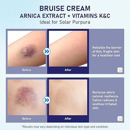 🌼🌼🌼🌼 Skin Recovery Care Balm ✨ – Soothing Support for Bruised & Sensitive Skin-QR