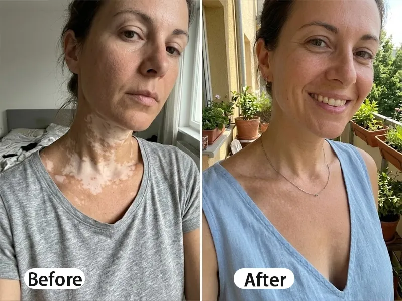 Before and After comparison