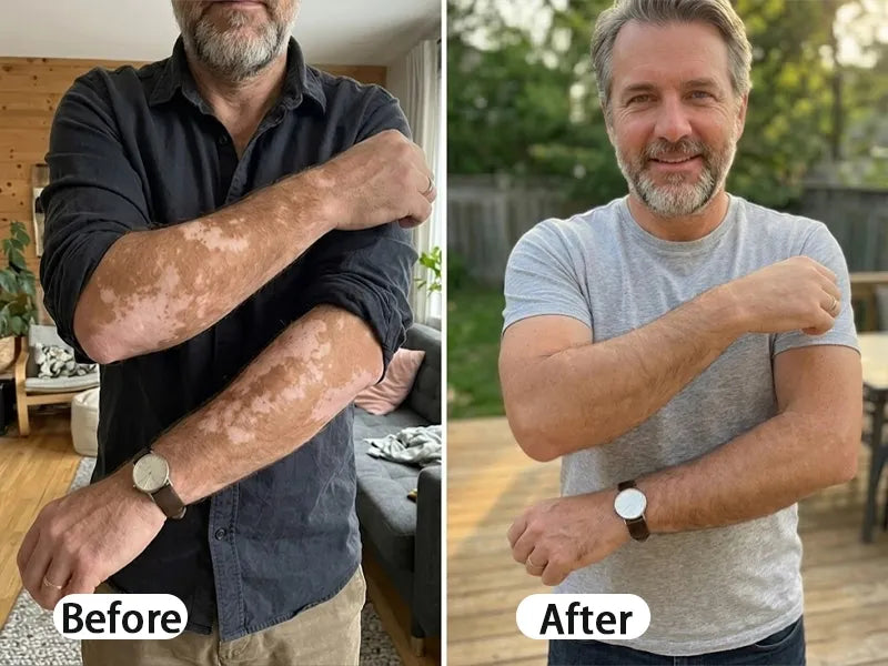 Before and After comparison