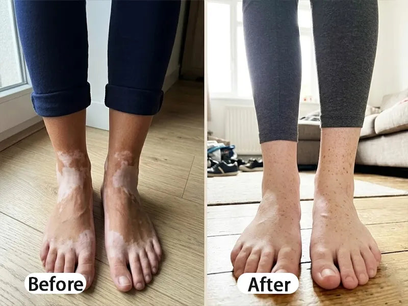 Before and After comparison