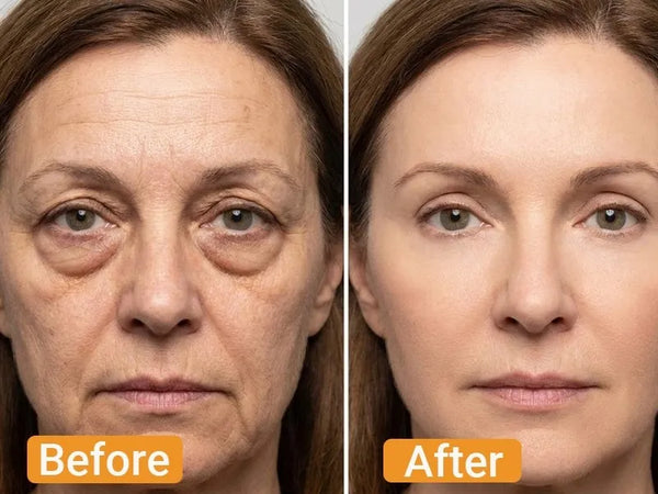 Before and After - Patricia Moore, 53