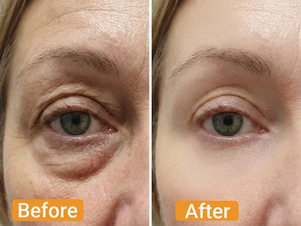 Before and After - Linda Chen,62