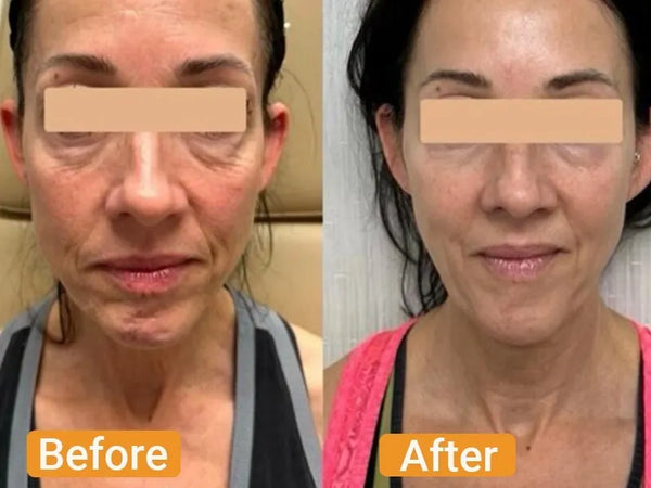 Before and After - Margaret Stevens,58