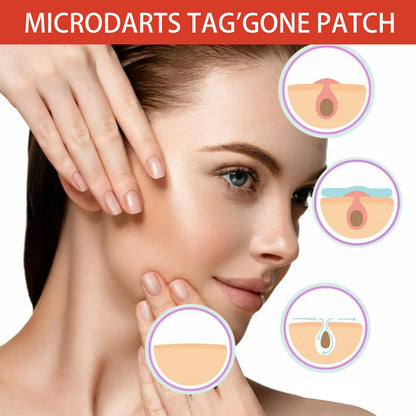 🚨 49% OFF TODAY ONLY MICRODARTS™ TAG'GONE PATCH ✨ 2-in-1 Microdart + Hydrocolloid Technology  ✨ Invisible Wear， Overnight Care，Face & Body-QO