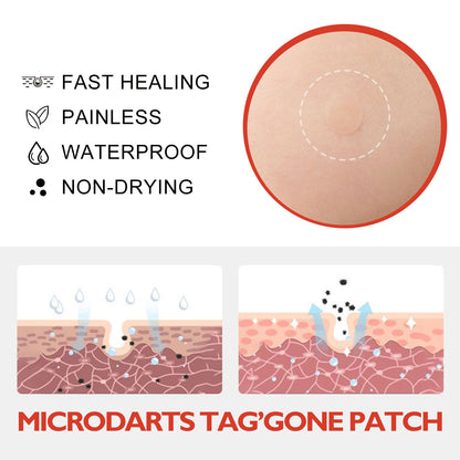 🚨 49% OFF TODAY ONLY MICRODARTS™ TAG'GONE PATCH ✨ 2-in-1 Microdart + Hydrocolloid Technology  ✨ Invisible Wear， Overnight Care，Face & Body-QO