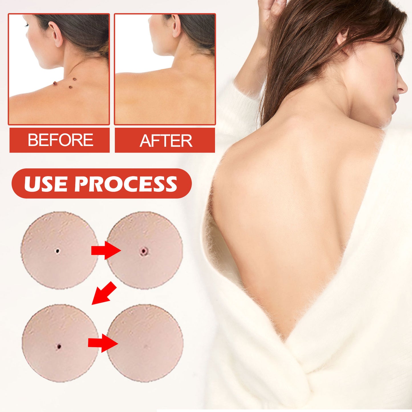 🚨 49% OFF TODAY ONLY MICRODARTS™ TAG'GONE PATCH ✨ 2-in-1 Microdart + Hydrocolloid Technology  ✨ Invisible Wear， Overnight Care，Face & Body-QO