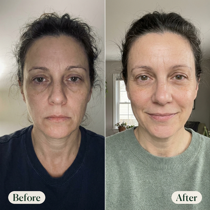 👁️✨ The Eye Essential Oil That Keeps Your Eyes Looking Smooth—Make you look 20 Years Younger 💖-QO